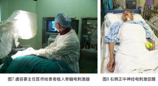 廣州協佳醫院有限公司，ICU重症康複，重症康複，康複醫(yī)學科(kē)